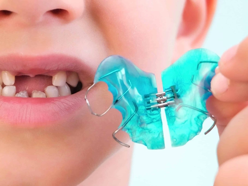 Atendimento de ortopedia funcional para crianças